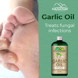 Garlic Oil – Prefect Addition to Your Daily Cooking & Healthy Routine [لہسن] 250ml - ChiltanPure