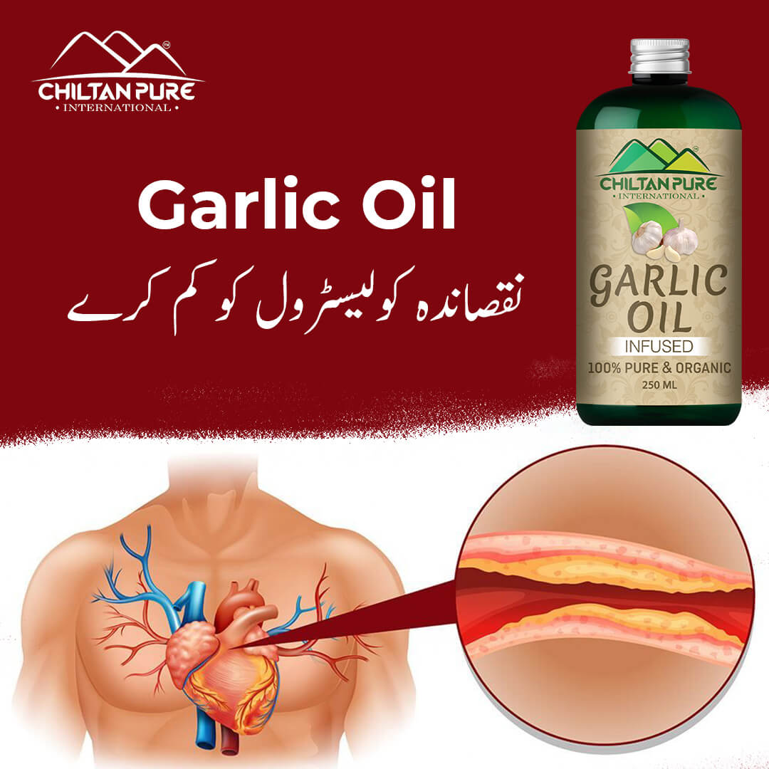 Garlic Oil – Prefect Addition to Your Daily Cooking & Healthy Routine [لہسن] 250ml - ChiltanPure