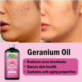Geranium Oil – Relax with sweet aroma – Contains anti-bacterial & anti-microbial properties, Reduces acne breakouts, cure skin infections – pure organic [Infused] 250ml - ChiltanPure