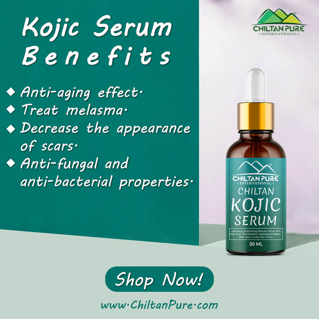 Kojic Serum – Time to fall in love with yourself, prevents hyperpigmentation, fades dark spots, treats melasma, minimizes discoloration – 100% pure organic 30ml - ChiltanPure