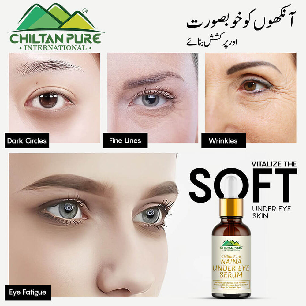 Naina Under Eye Serum – For Firm Delicate Skin, Support firm refreshed look – Reduce fine lines, Dark circles & Puffiness (100% result) - ChiltanPure
