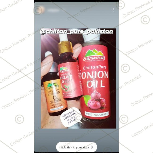 Red Onion Oil 🧅 Reduces Hair Fall &amp; Accelerates Hair Regrowth [پیاز کا تیل].. Trending.... 🔥 - ChiltanPure
