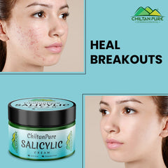 Salicylic Cream – Exfoliates Skin, Anti-Acne, Lighten Acne Scars, Makes Skin Healthy & Glowing - ChiltanPure