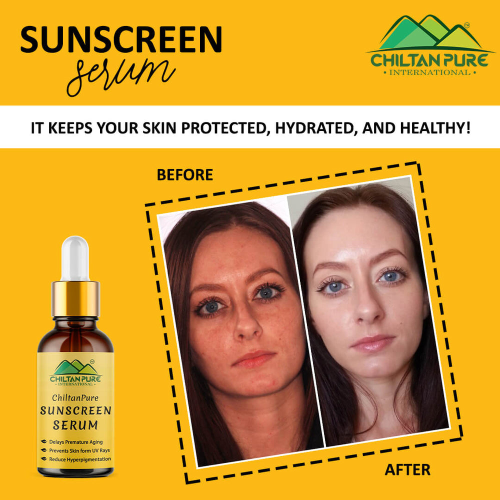Sunscreen Serum – Delays Premature Aging, Prevents Skin from UV Rays, Reduce Hyperpigmentation & Risk of Skin Cancer 30ml - ChiltanPure
