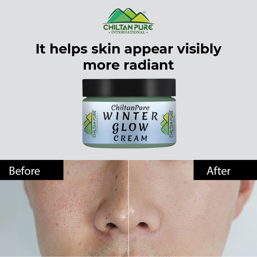 Winter Glow Cream – Formulated With Multivitamins & Moisturizers, Makes Skin Soft & Supple, Good For Dry & Dehydrated Skin - ChiltanPure