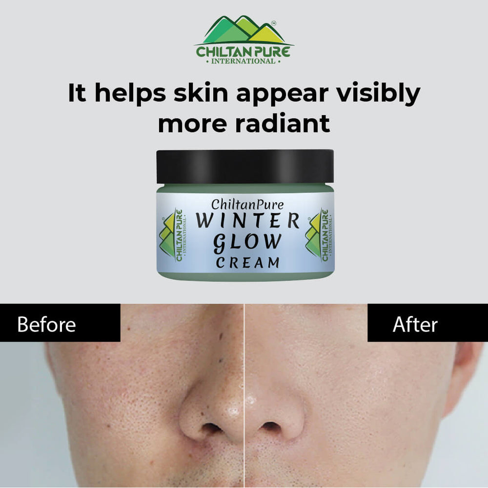Winter Glow Cream – Formulated With Multivitamins & Moisturizers, Makes Skin Soft & Supple, Good For Dry & Dehydrated Skin - ChiltanPure